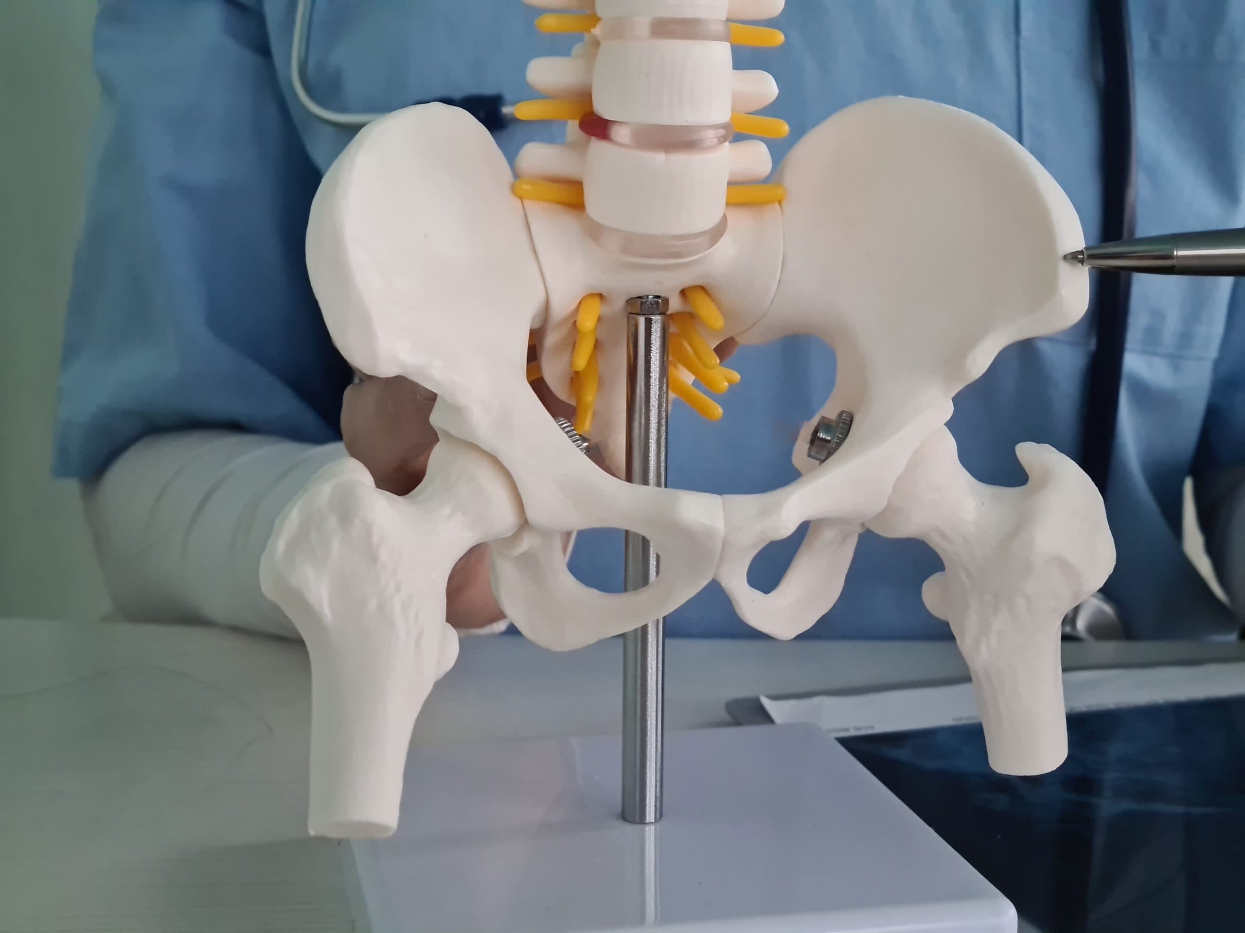 Hip Replacement Surgery Near Me in Chamrajpet: Procedure, Recovery and Expert Orthopaedic Care at Brindhavvan Areion Hospital