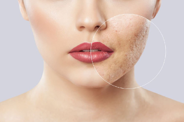 Dermatology