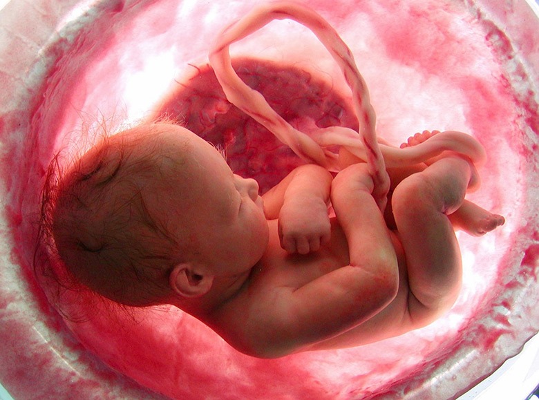 OBG & GYNAE