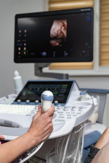 Ultra Sound Scan