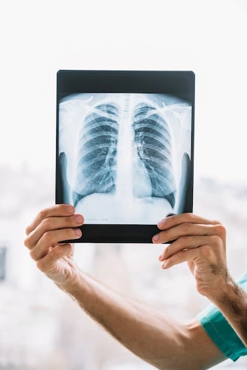 X-Ray