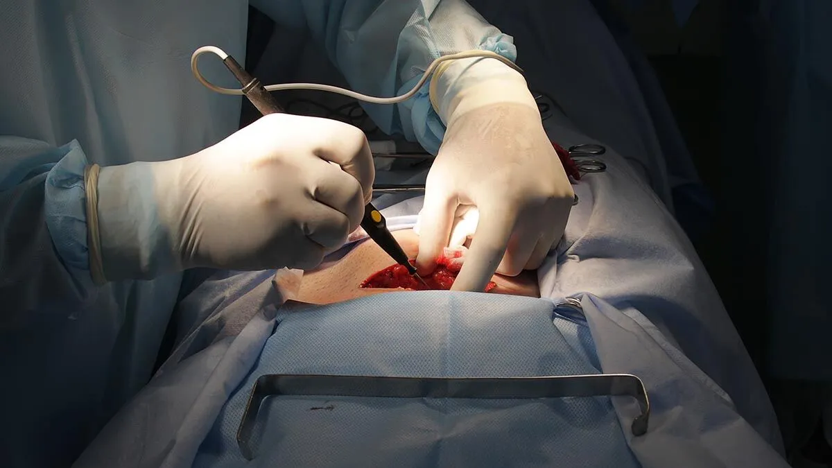 General Surgery