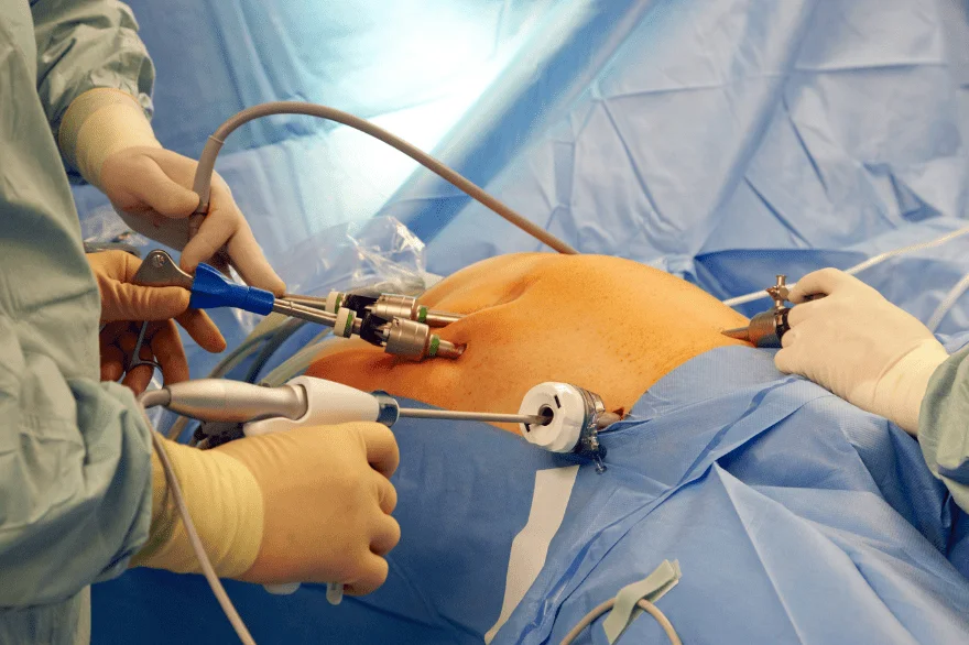 Onco Surgery