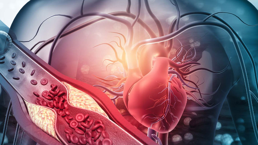 Vascular Surgery